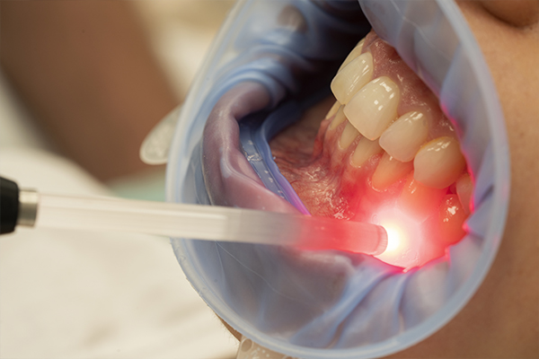 Laserterapia Vila Carrão