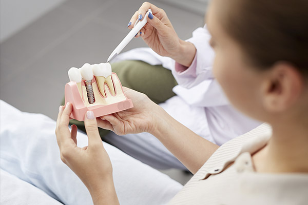 Implante Dentário Vila Carrão ArtOral Melhores Dentistas ZL